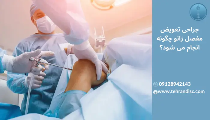 جراحی تعویض مفصل زانو چگونه انجام می شود؟