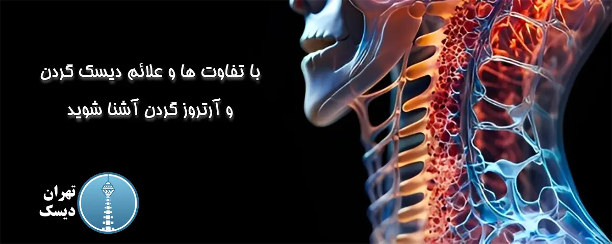 تفاوت بین دیسک گردن و آرتروز گردن