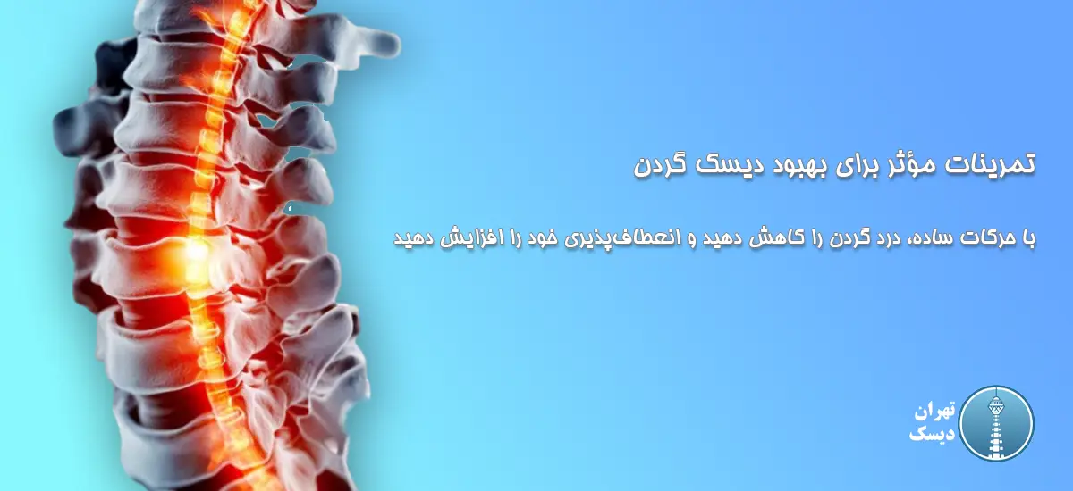 تمرینات مؤثر برای بهبود دیسک گردن