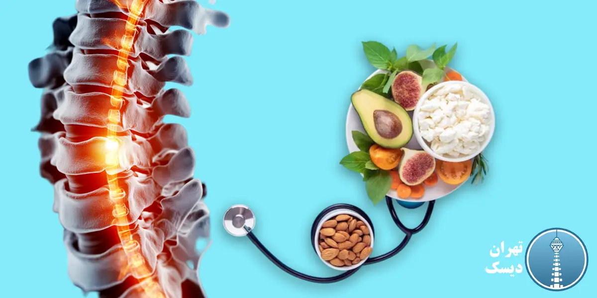 نقش تغذیه در پیشگیری از دیسک گردن